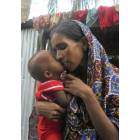 Suor Roberta e malati di lebbra del Damien Hospital di Khulna-8